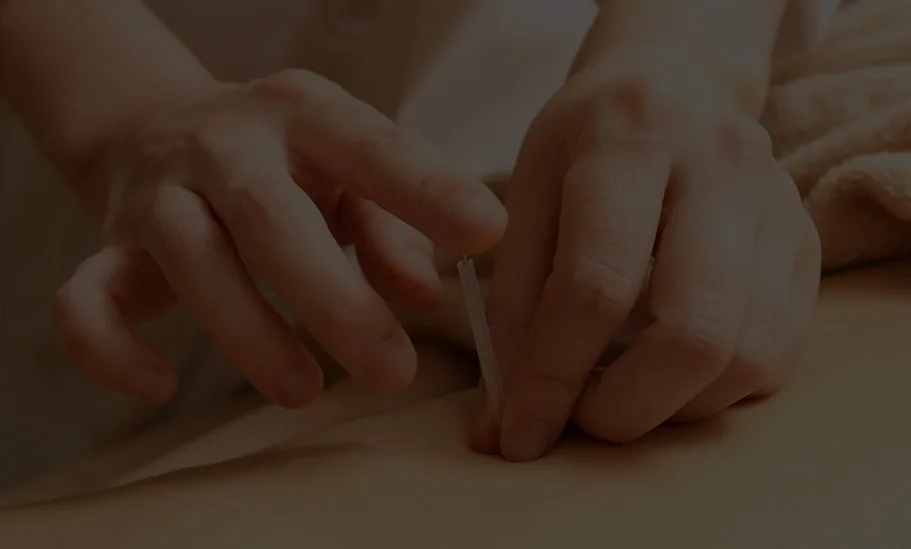 Acupuncture needle technique in dermatology treatment